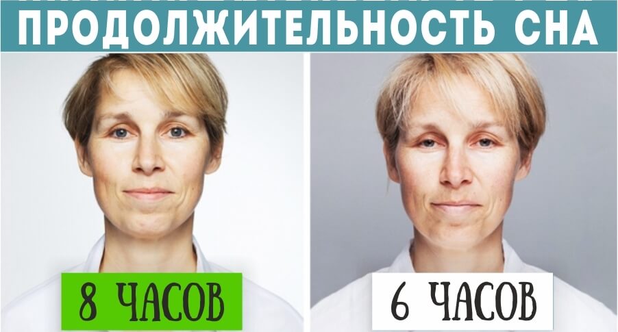 Недосыпание и состояние кожи лица